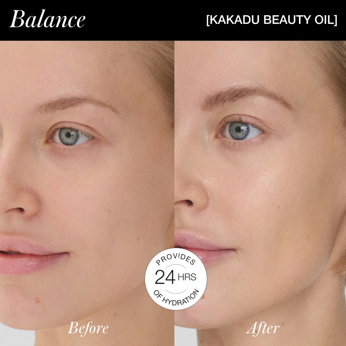 RMS BEAUTY | KAKADU BEAUTY OIL